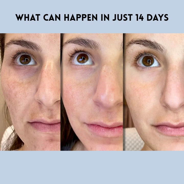 La solution instantanée pour une beauté intemporelle (1+1 GRATUIT)